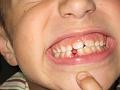 1023tooth1